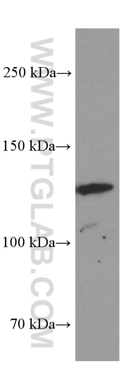 Western Blot (WB) analysis of SGC-7901 cells using AMOT Monoclonal antibody (60156-1-Ig)