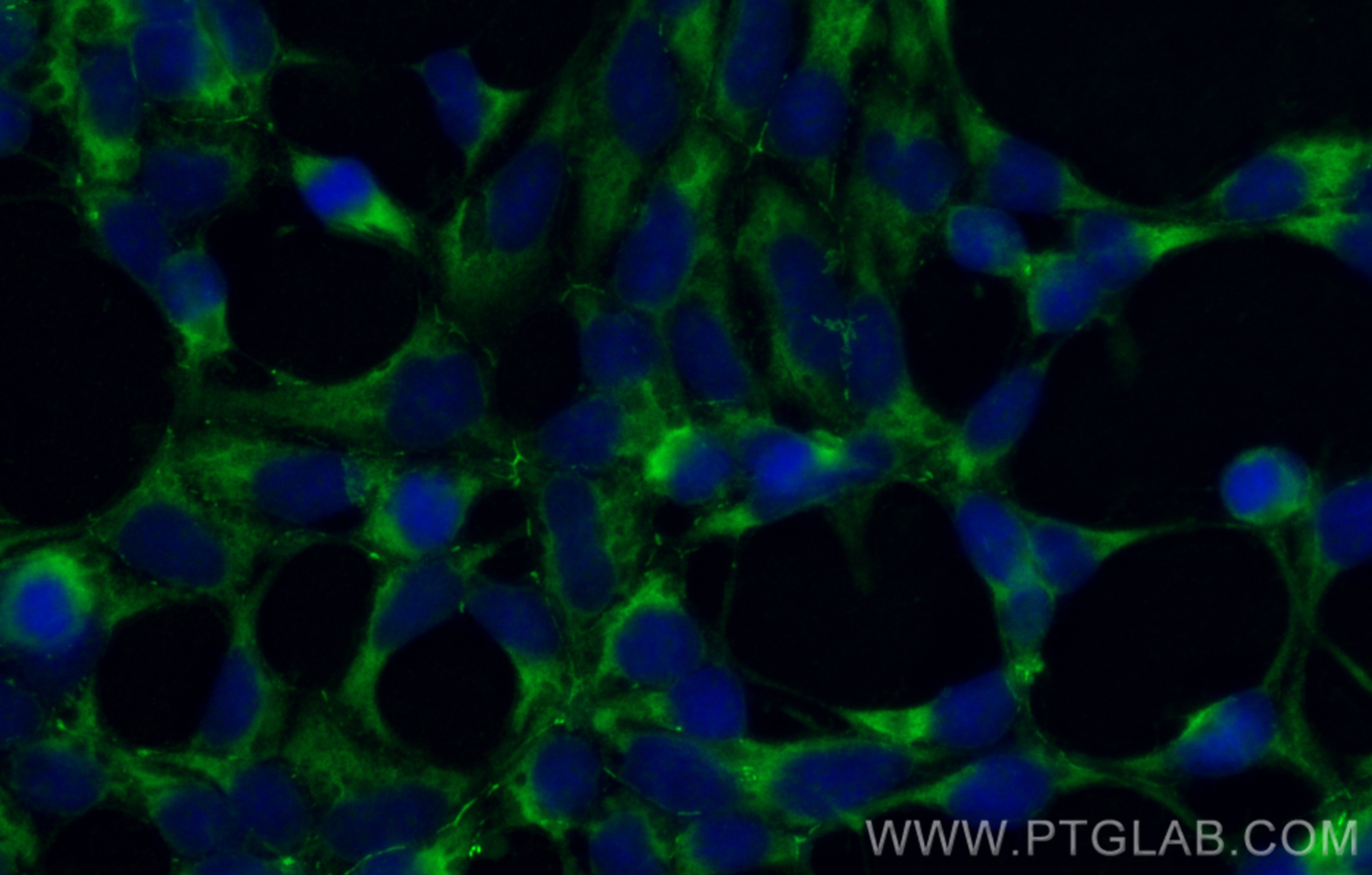 Immunofluorescence (IF) / fluorescent staining of HEK-293 cells using CoraLite® Plus 488-conjugated AMOT Polyclonal anti (CL488-24550)
