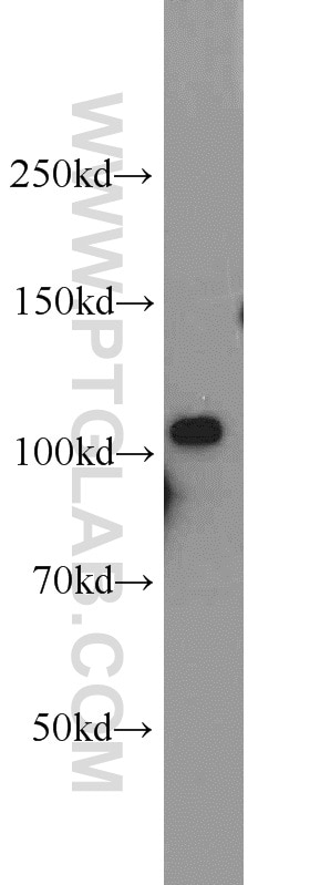 Western Blot (WB) analysis of HeLa cells using AMOTL1 Polyclonal antibody (16871-1-AP)