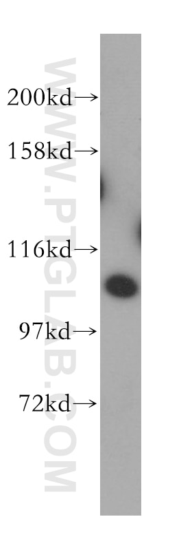 Western Blot (WB) analysis of HeLa cells using AMOTL1 Polyclonal antibody (16871-1-AP)