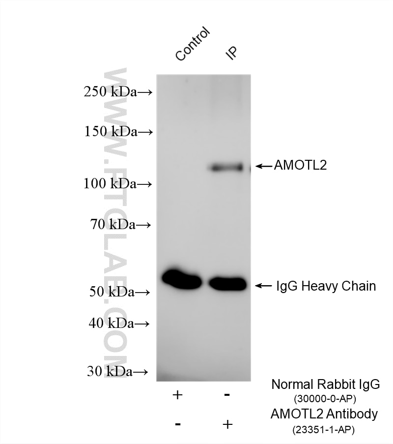 Immunoprecipitation (IP) experiment of HEK-293 cells using AMOTL2 Polyclonal antibody (23351-1-AP)