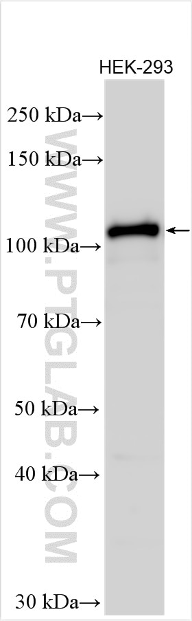 Western Blot (WB) analysis of various lysates using AMOTL2 Polyclonal antibody (23351-1-AP)