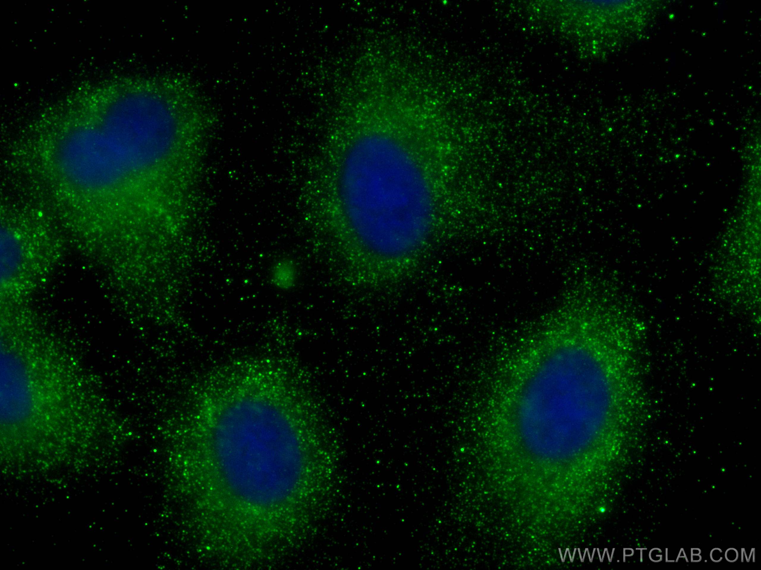 Immunofluorescence (IF) / fluorescent staining of A549 cells using AMOTL2 Monoclonal antibody (68401-1-Ig)