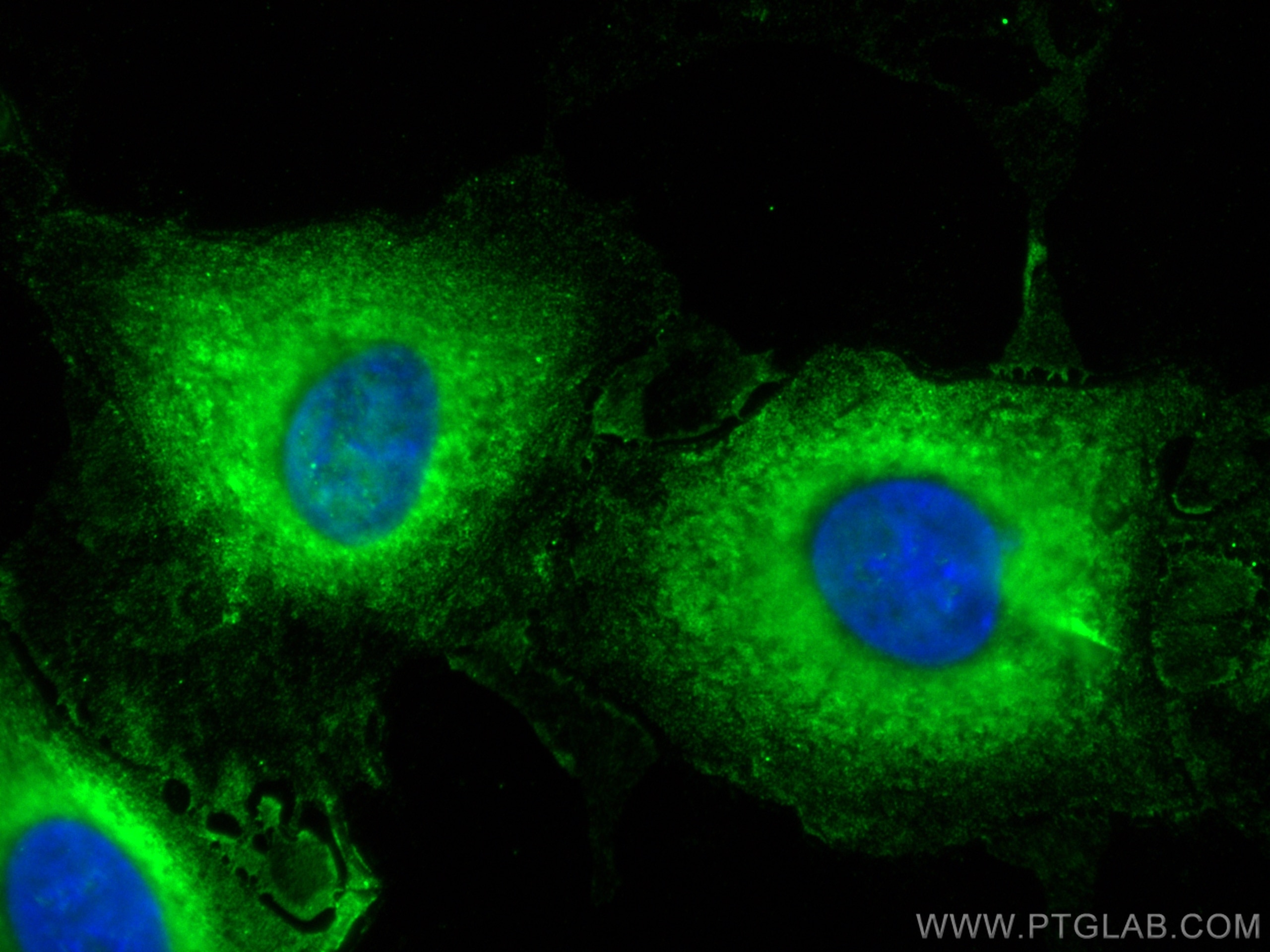 IF Staining of A549 using CL488-68401