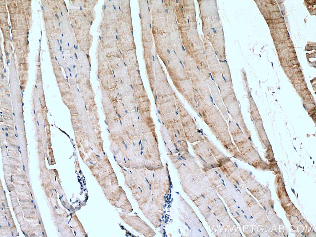 Immunohistochemistry (IHC) staining of mouse skeletal muscle tissue using AMPD1-Specific Polyclonal antibody (19780-1-AP)