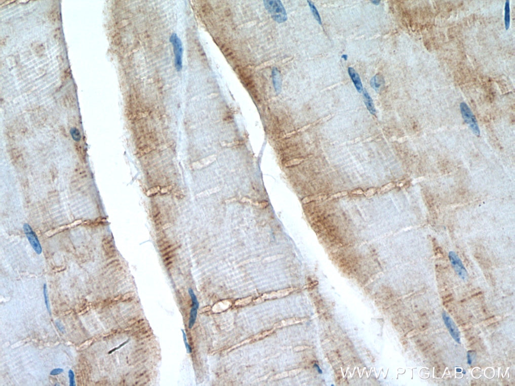 Immunohistochemistry (IHC) staining of mouse skeletal muscle tissue using AMPD1-Specific Polyclonal antibody (19780-1-AP)