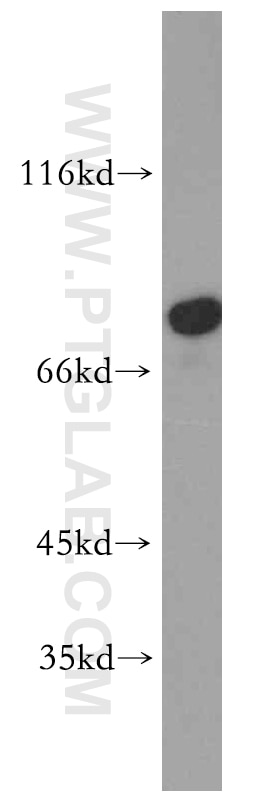 Western Blot (WB) analysis of mouse skeletal muscle tissue using AMPD1-Specific Polyclonal antibody (19780-1-AP)