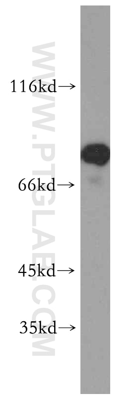 Western Blot (WB) analysis of mouse skeletal muscle tissue using AMPD1-Specific Polyclonal antibody (19780-1-AP)