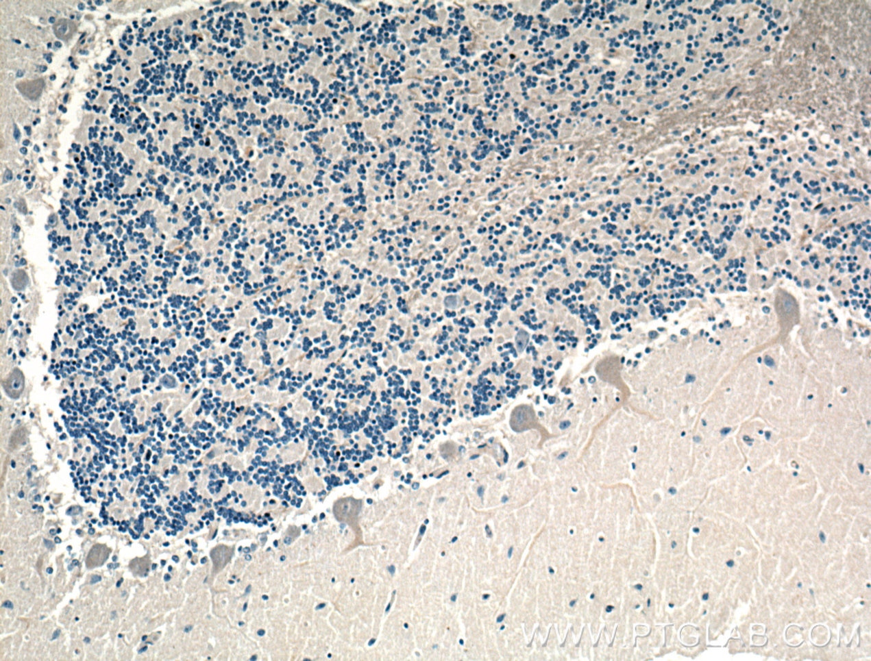 Immunohistochemistry (IHC) staining of human cerebellum tissue using AMPD2 Polyclonal antibody (15710-1-AP)