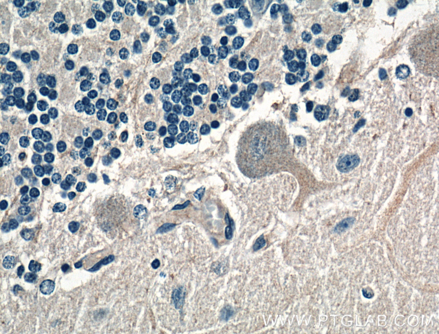 Immunohistochemistry (IHC) staining of human cerebellum tissue using AMPD2 Polyclonal antibody (15710-1-AP)