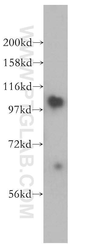 Western Blot (WB) analysis of human liver tissue using AMPD2 Polyclonal antibody (15710-1-AP)