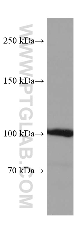 Western Blot (WB) analysis of HepG2 cells using AMPD2 Monoclonal antibody (67430-1-Ig)