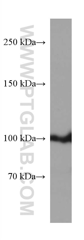 WB analysis of L02 using 67430-1-Ig