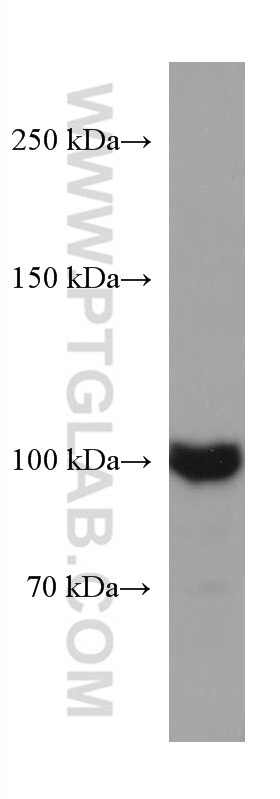 Western Blot (WB) analysis of HSC-T6 cells using AMPD2 Monoclonal antibody (67430-1-Ig)