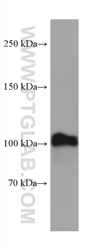 Western Blot (WB) analysis of 4T1 cells using AMPD2 Monoclonal antibody (67430-1-Ig)