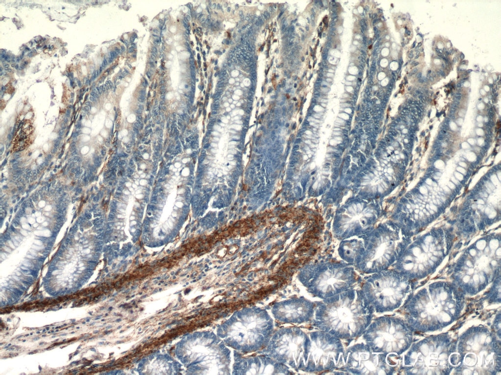 Immunohistochemistry (IHC) staining of human colon tissue using AMPD3 Polyclonal antibody (23997-1-AP)