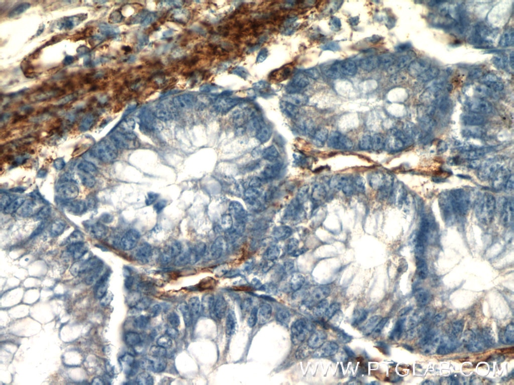 Immunohistochemistry (IHC) staining of human colon tissue using AMPD3 Polyclonal antibody (23997-1-AP)