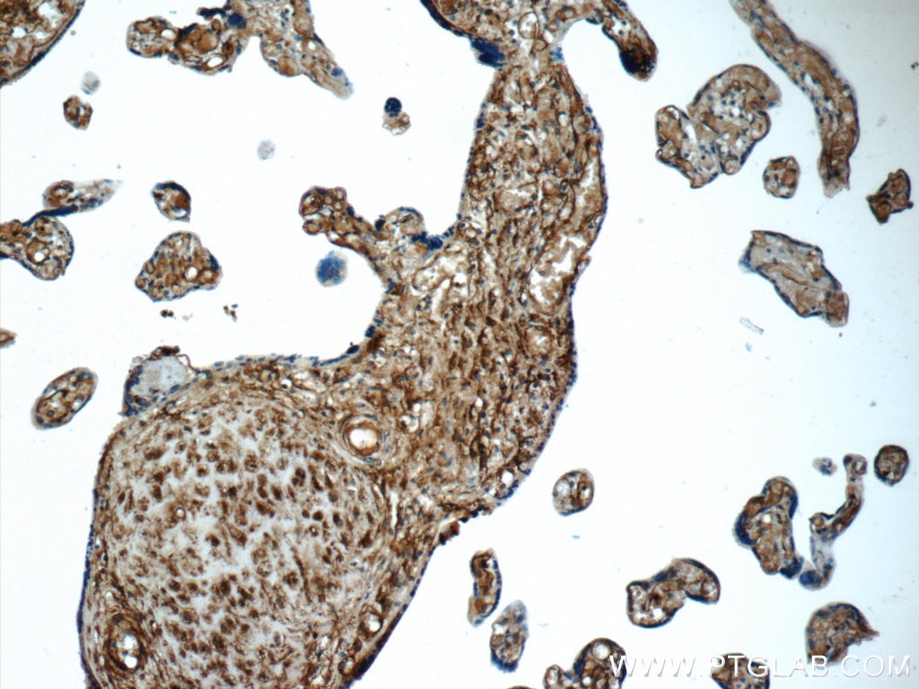 IHC staining of human placenta using 23997-1-AP