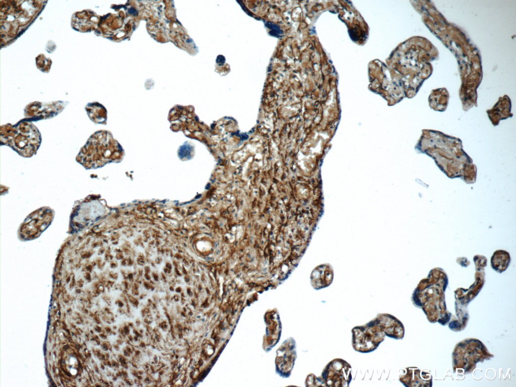 AMPD3