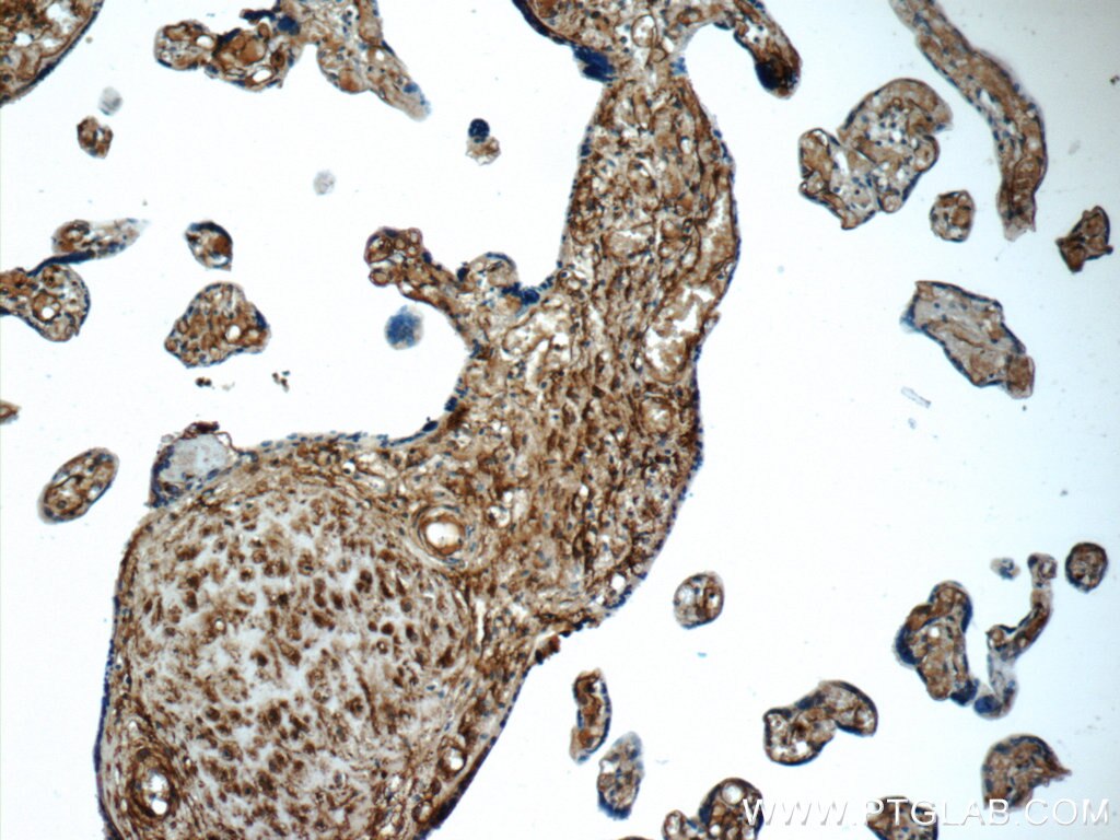 Immunohistochemistry (IHC) staining of human placenta tissue using AMPD3 Polyclonal antibody (23997-1-AP)