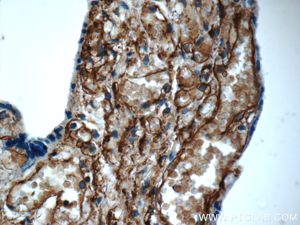 Immunohistochemistry (IHC) staining of human placenta tissue using AMPD3 Polyclonal antibody (23997-1-AP)