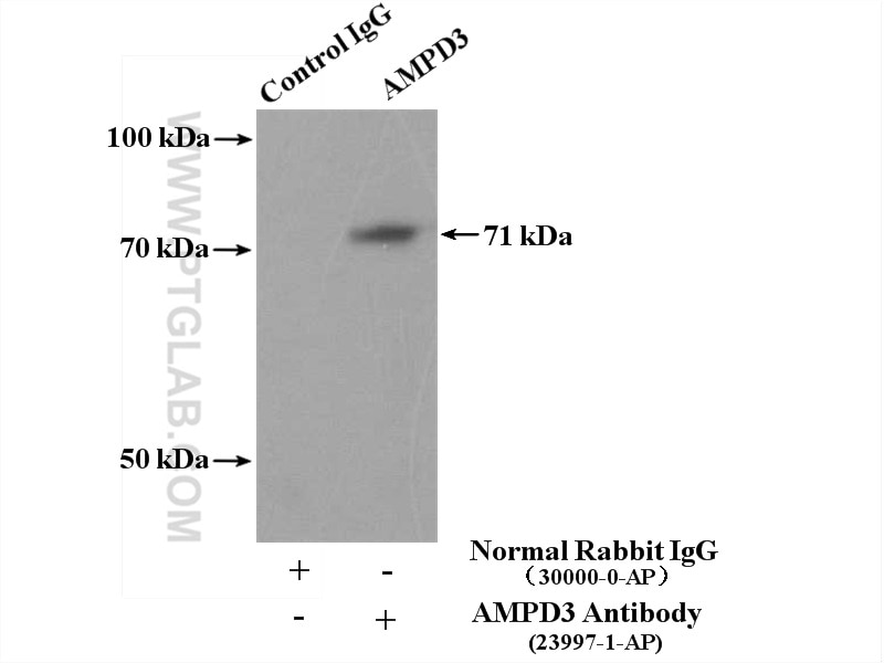Immunoprecipitation (IP) experiment of mouse kidney tissue using AMPD3 Polyclonal antibody (23997-1-AP)
