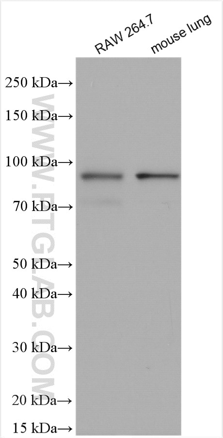 Western Blot (WB) analysis of various lysates using AMPD3 Polyclonal antibody (23997-1-AP)