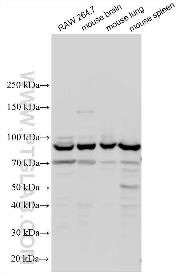 Various lysates were subjected to SDS PAGE followed by western blot with 23997-1-AP (AMPD3 antibody) at dilution of 1:1000 incubated at room temperature for 1.5 hours. Western Blot (WB) analysis of various lysates using AMPD3 Polyclonal antibody (23997-1-AP)