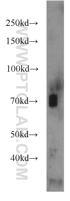 Western Blot (WB) analysis of mouse kidney tissue using AMPD3 Polyclonal antibody (23997-1-AP)