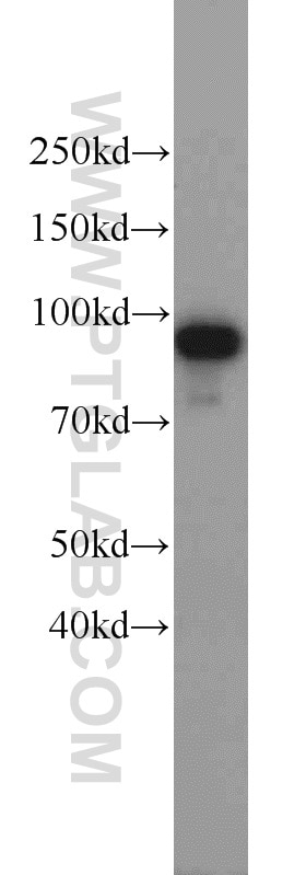 Western Blot (WB) analysis of mouse lung tissue using AMPD3 Polyclonal antibody (23997-1-AP)