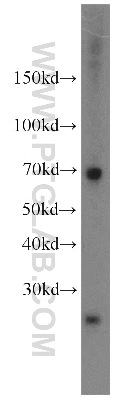 Western Blot (WB) analysis of rat kidney tissue using AMPD3 Polyclonal antibody (23997-1-AP)