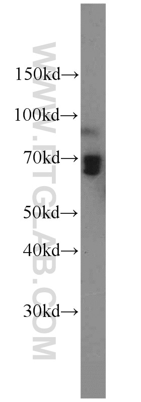 Western Blot (WB) analysis of HEK-293 cells using AMPD3 Polyclonal antibody (23997-1-AP)