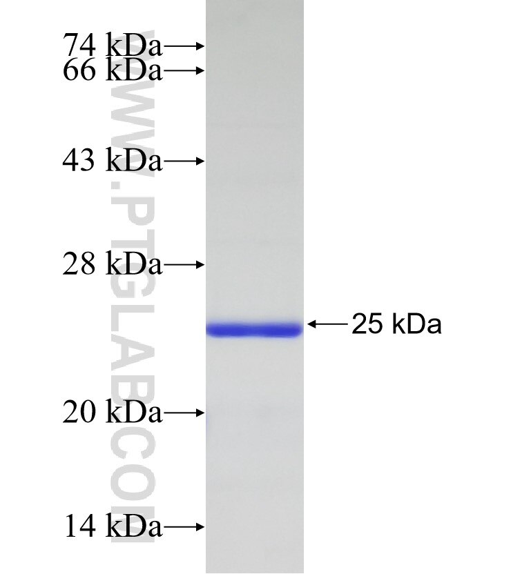 AMPD3 fusion protein Ag33050 SDS-PAGE