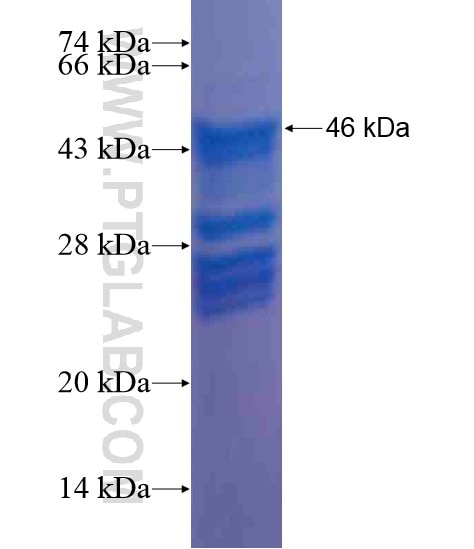AMPD3 fusion protein Ag21199 SDS-PAGE