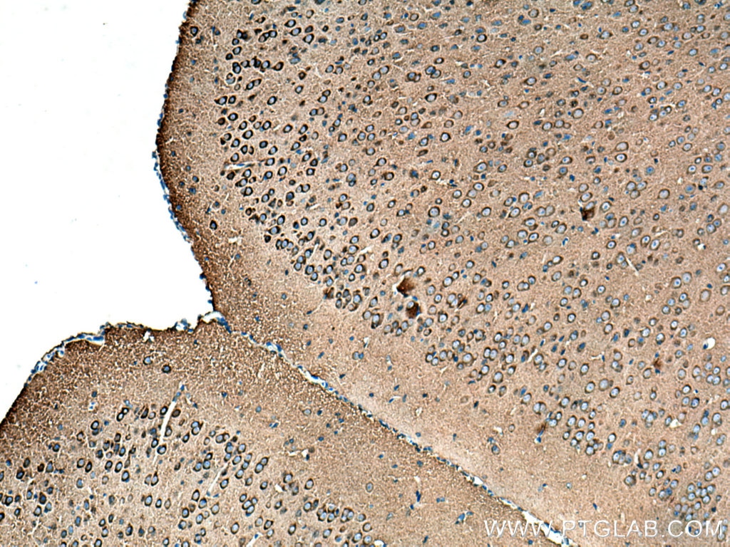 Immunohistochemistry (IHC) staining of mouse brain tissue using Amphiphysin Polyclonal antibody (13379-1-AP)