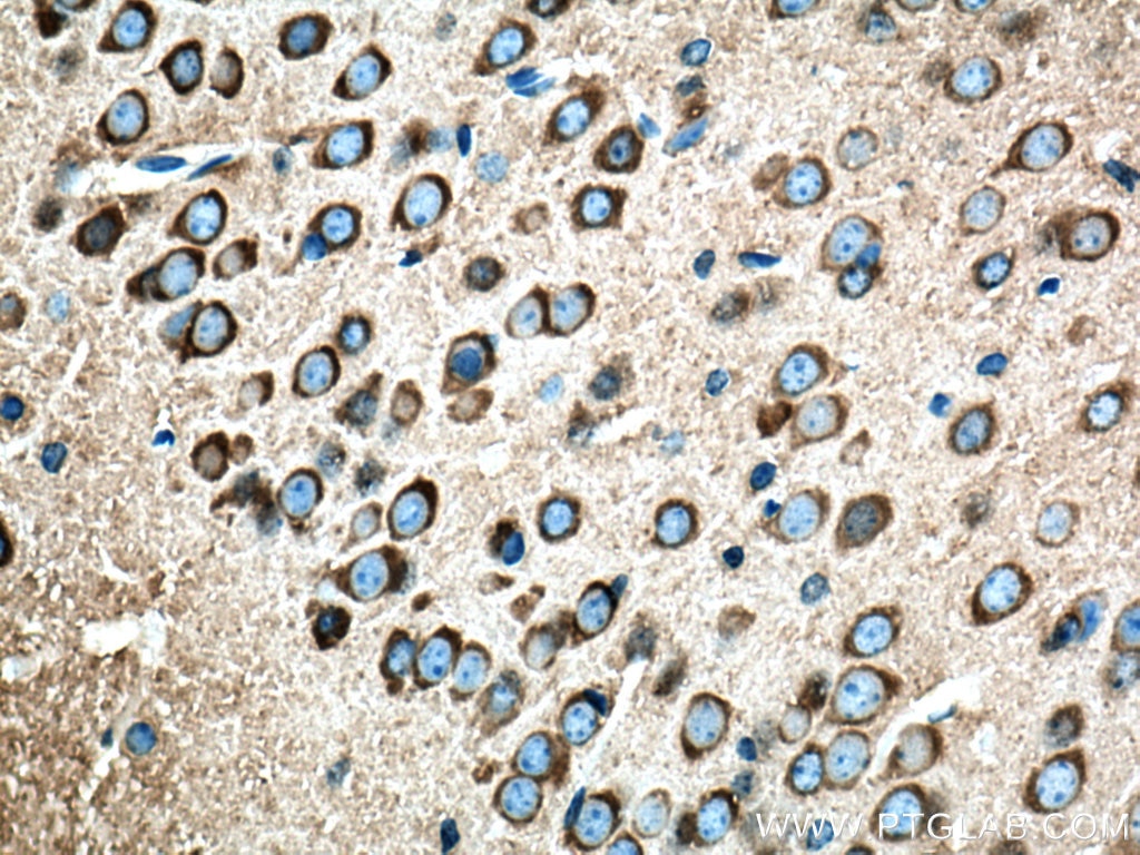 Immunohistochemistry (IHC) staining of mouse brain tissue using Amphiphysin Polyclonal antibody (13379-1-AP)
