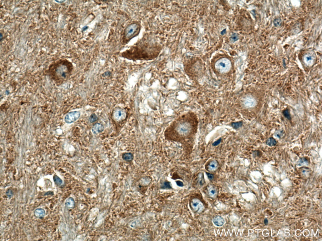 Immunohistochemistry (IHC) staining of mouse cerebellum tissue using Amphiphysin Polyclonal antibody (13379-1-AP)