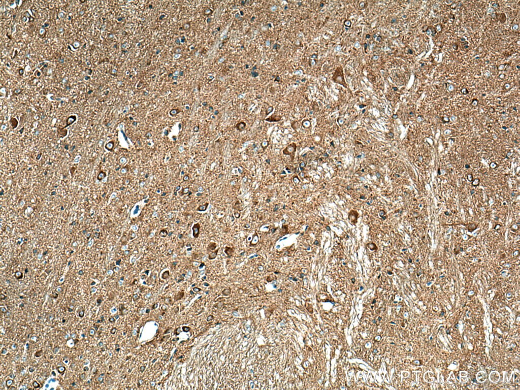 Immunohistochemistry (IHC) staining of mouse cerebellum tissue using Amphiphysin Polyclonal antibody (13379-1-AP)