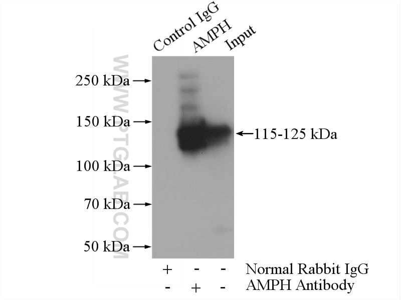 Immunoprecipitation (IP) experiment of mouse brain tissue using Amphiphysin Polyclonal antibody (13379-1-AP)