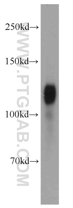 Western Blot (WB) analysis of mouse brain tissue using Amphiphysin Polyclonal antibody (13379-1-AP)