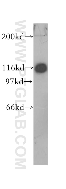 Western Blot (WB) analysis of mouse lung tissue using Amphiphysin Polyclonal antibody (13379-1-AP)