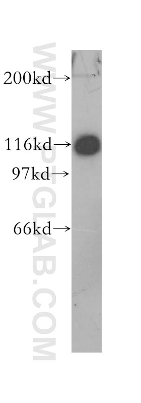 WB analysis of mouse lung using 13379-1-AP