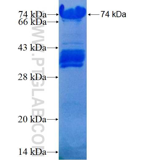 AMPH fusion protein Ag4204 SDS-PAGE