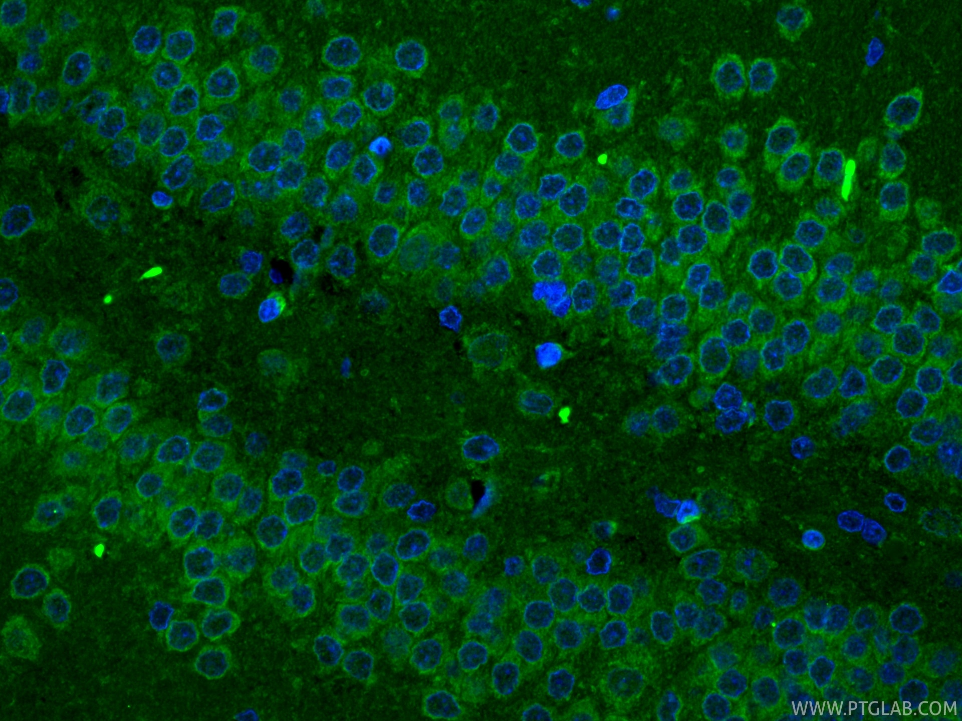 Immunofluorescent analysis of (4% PFA) fixed paraffin-embedded rat brain tissue using CoraLite® Plus 488 AMPK Alpha antibody (CL488-80209-5, Clone: 4N5 ) at dilution of 1:200. Heat mediated antigen retrieval with Tris-EDTA buffer (pH 9.0). Immunofluorescence (IF) / fluorescent staining of rat brain tissue using CoraLite® Plus 488-conjugated AMPK Alpha Recombina (CL488-80209-5)