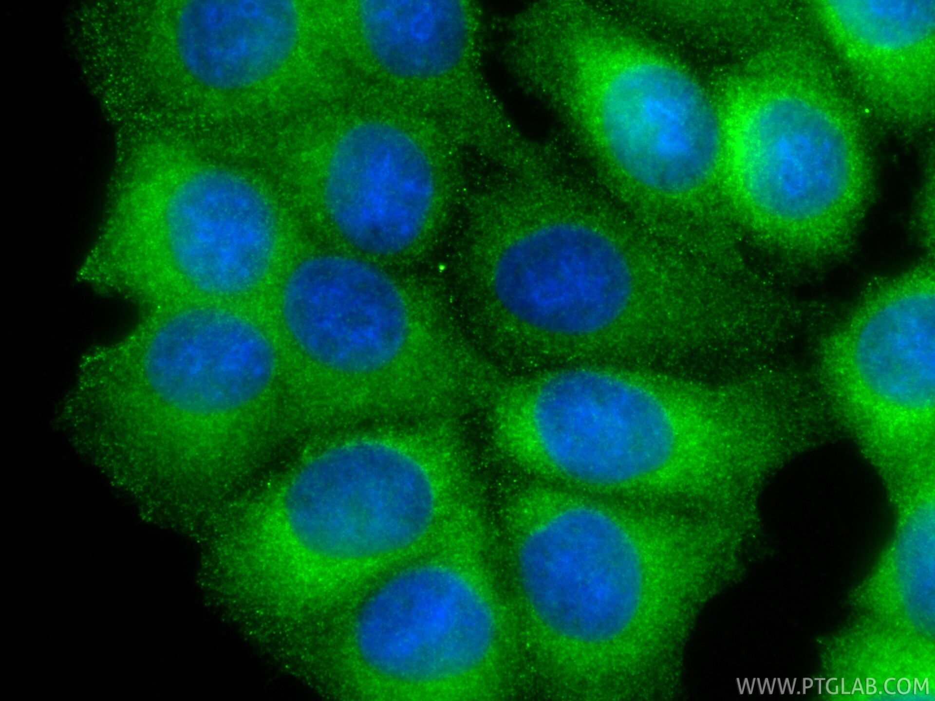 IF Staining of MCF-7 using 88497-1-RR Immunofluorescence (IF) / fluorescent staining of MCF-7 cells using AMPK Beta 1 Recombinant monoclonal antibody (88497-1-RR)