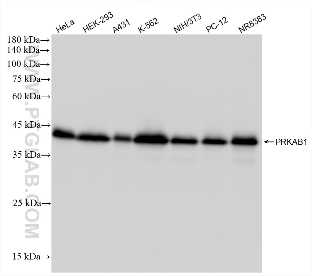 WB analysis using 88497-1-RR Western Blot (WB) analysis of various lysates using AMPK Beta 1 Recombinant monoclonal antibody (88497-1-RR)