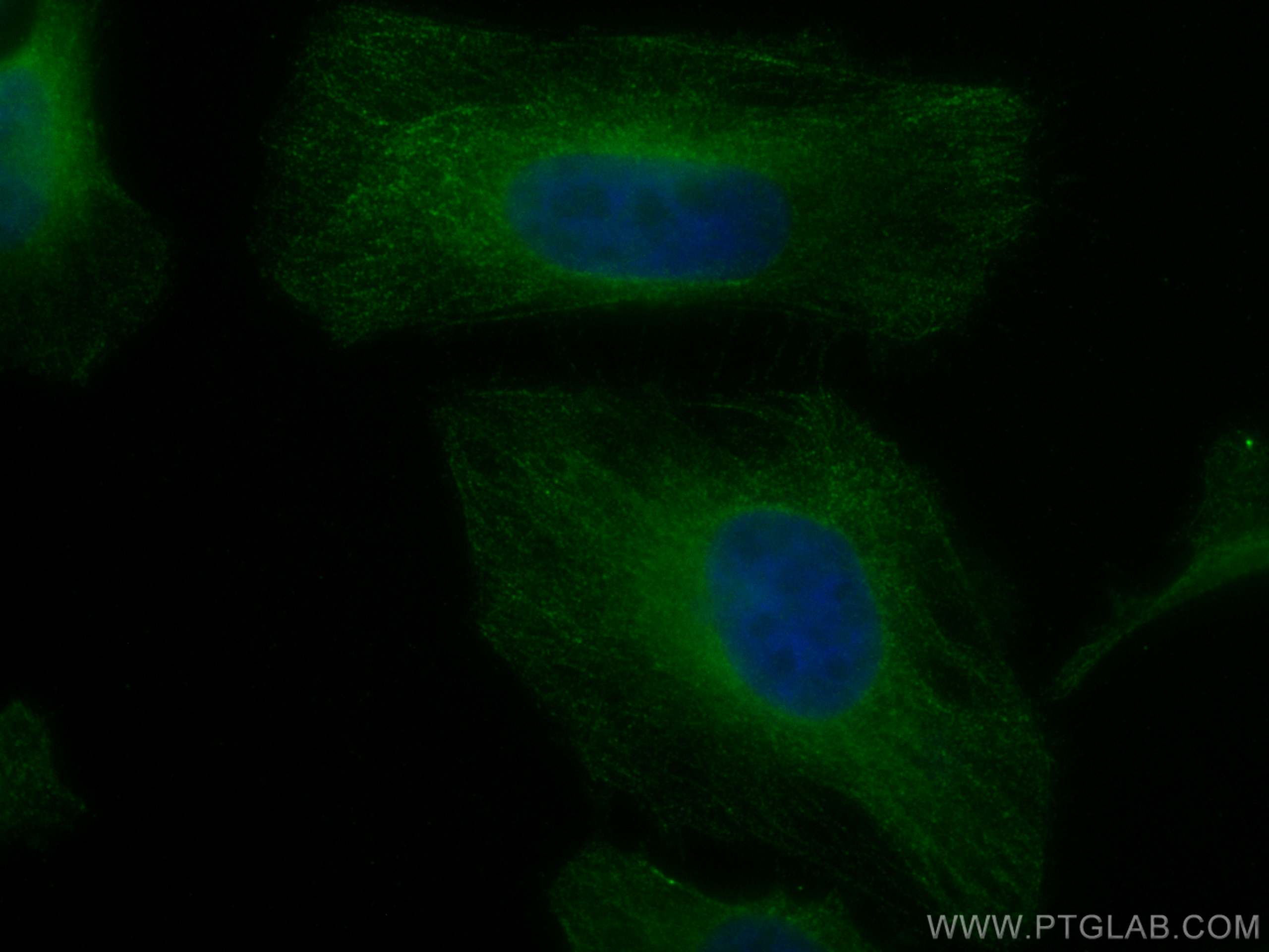 Immunofluorescence (IF) / fluorescent staining of HeLa cells using CoraLite® Plus 488-conjugated AMPK Beta 2 Monoclon (CL488-66579)