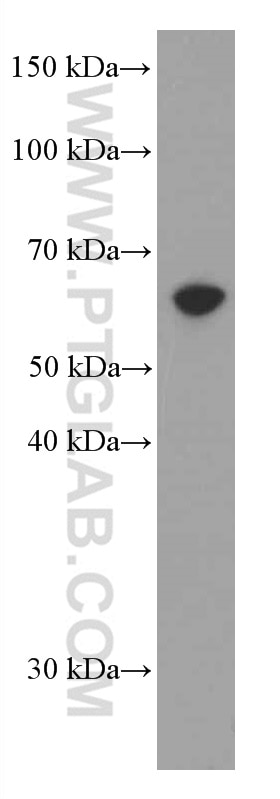 Western Blot (WB) analysis of Jurkat cells using AMPK Alpha 1 Monoclonal antibody (66536-1-Ig)