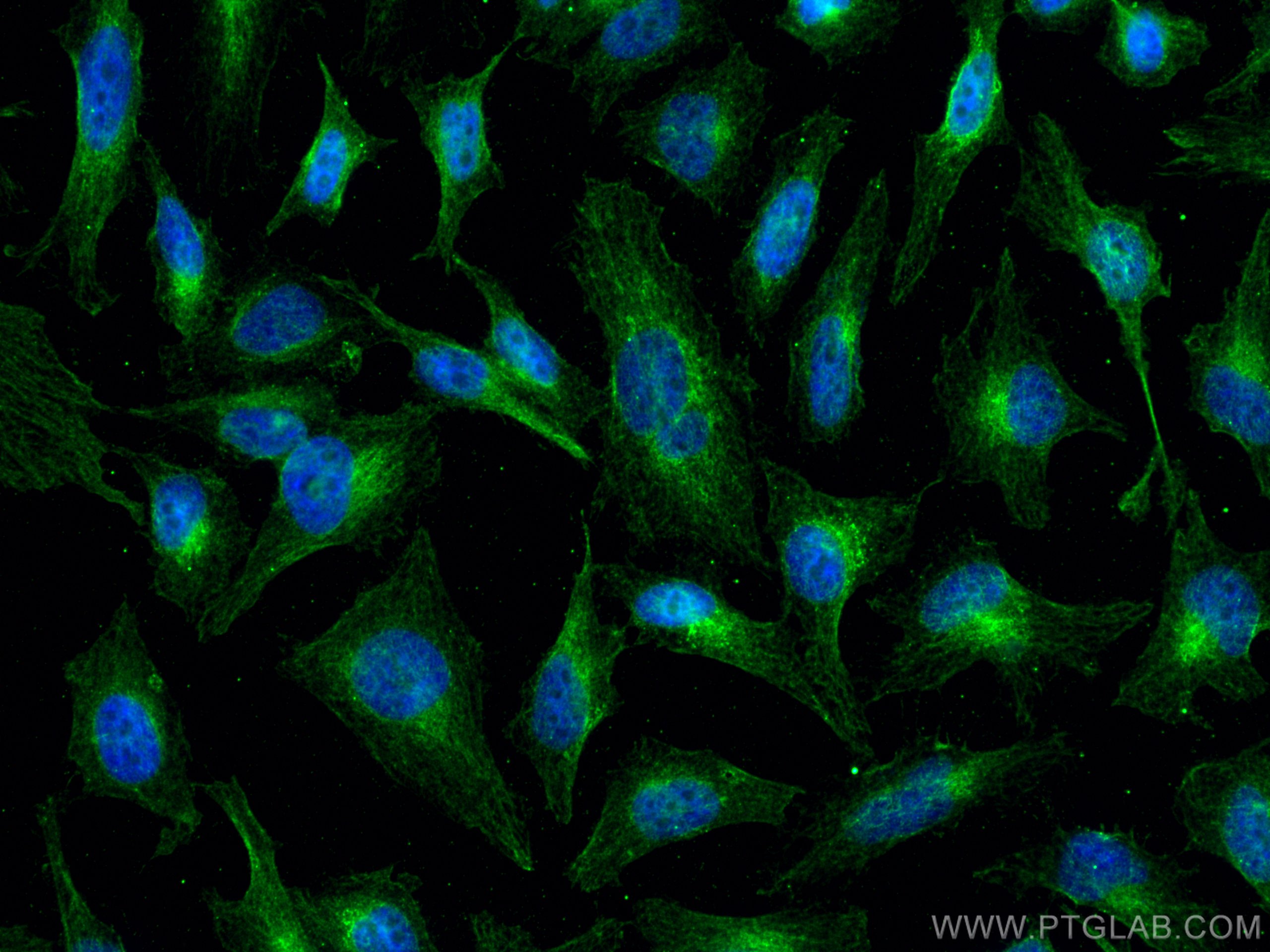 Immunofluorescence (IF) / fluorescent staining of HeLa cells using AMPK Beta 2 Monoclonal antibody (66579-1-Ig)