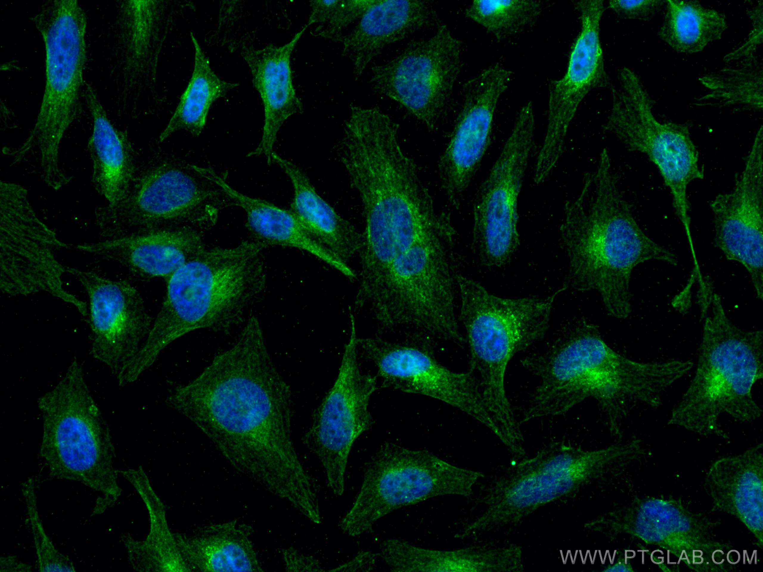 IF Staining of HeLa using 66579-1-Ig